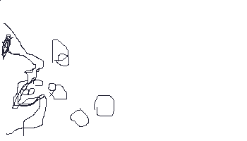 stone